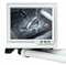 Фото - Система водяного охлаждения Asus ROG Ryujin III 360 ARGB Extreme White (90RC0132-M0EAY0) | click.ua