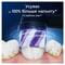 Фото - Насадка для зубной электрощетки Braun Oral-B iO RB WB Radiant White Black (4 шт) | click.ua